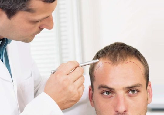 Tips For Huge Success As A Hair Transplant Entity