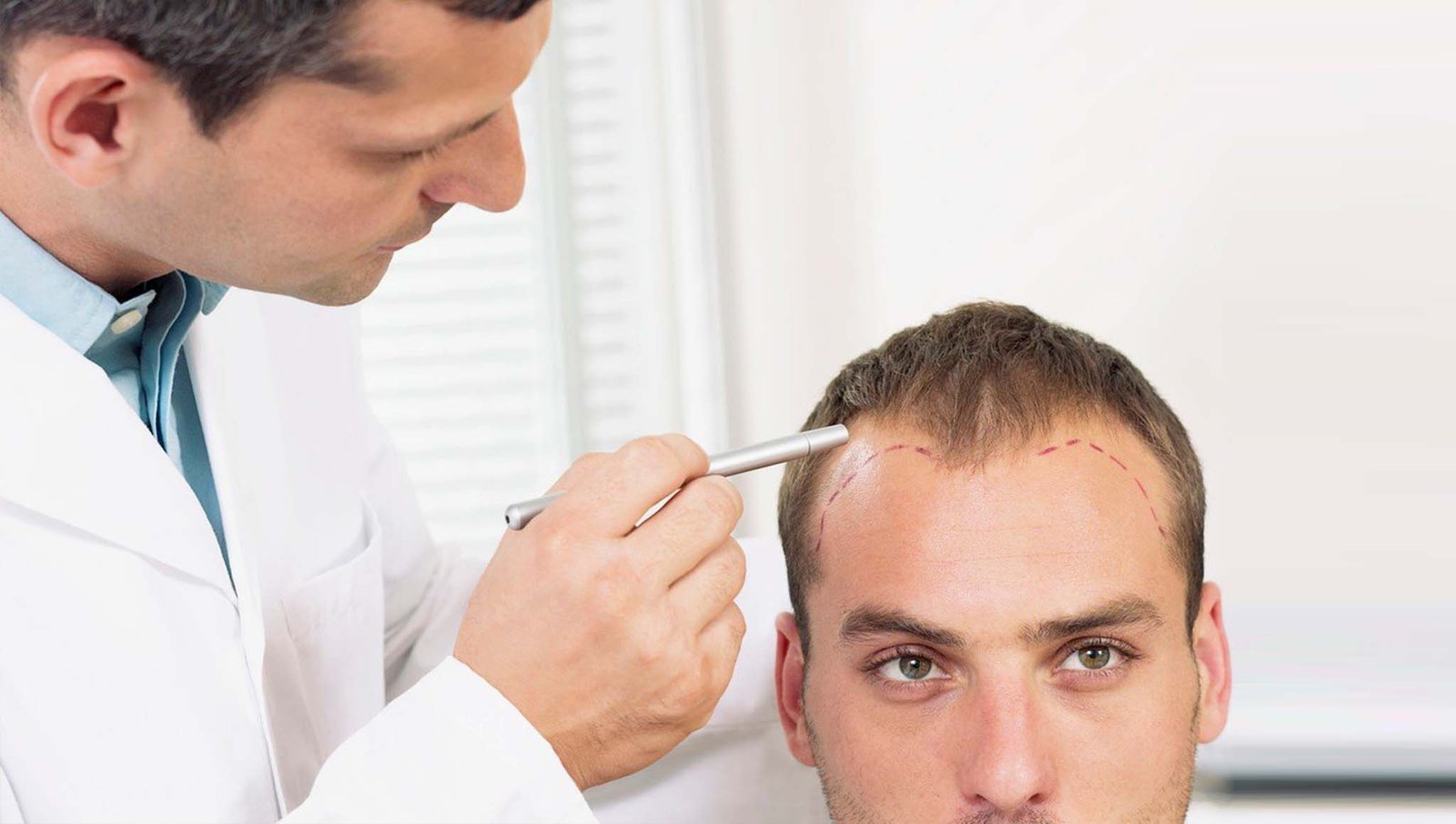 Tips For Huge Success As A Hair Transplant Entity