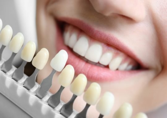 The Top Five Steps For Doing Dental Implants The Right Way