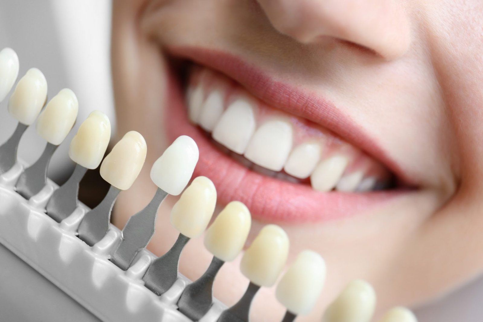 The Top Five Steps For Doing Dental Implants The Right Way
